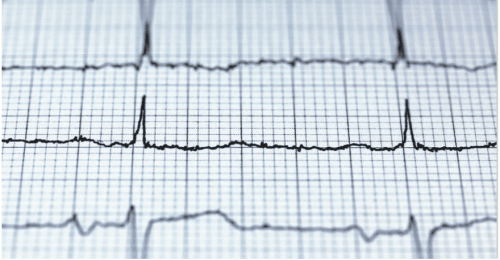 Che cos'è la coerenza cardiaca?