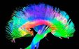 Il Risveglio della Coscienza